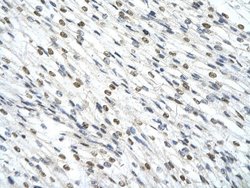 SMARCD2 Rabbit anti-Human, Polyclonal, Novus Biologicals 100 &mu;g; Unconjugated:Antibodies,